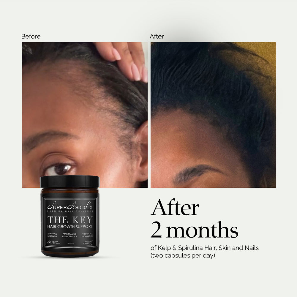
                      
                        THE KEY HAIR GROWTH SUPPORT
                      
                    