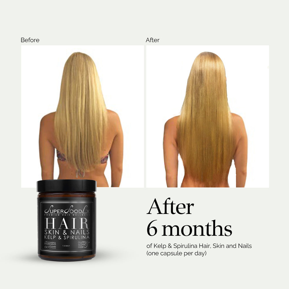 
                      
                        HAIR, SKIN AND NAILS SUPPLEMENT
                      
                    