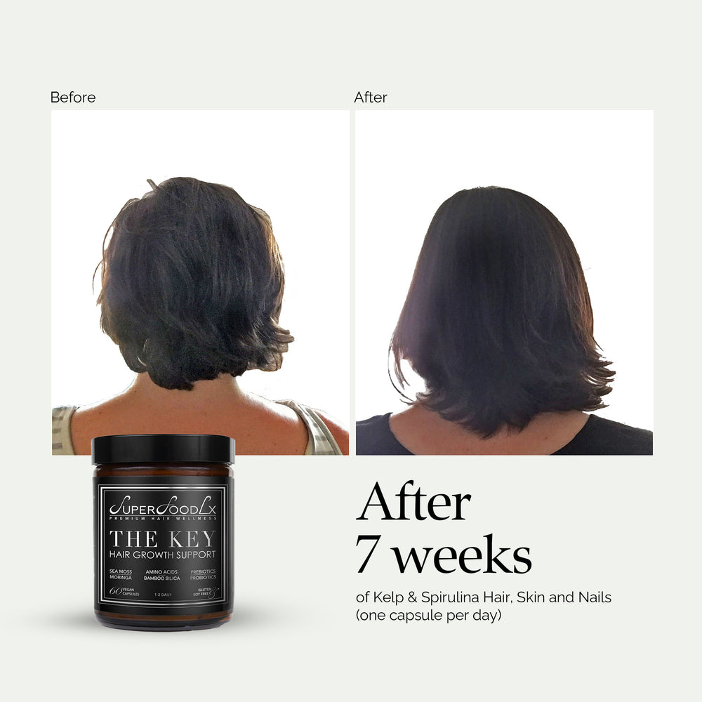 
                      
                        THE KEY HAIR GROWTH SUPPORT
                      
                    